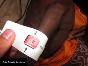 MALNUTRICION-FOTO-TOMADA-DE-INTERNET-4