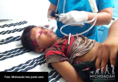 Vecinos de la comunidad denunciaron que elementos del Ejército mexicano impactaron sus vehículos con los puestos de vigilancia y luego dispararon en contra de pobladores de la zona; un niño fue alcanzado por las balas. 